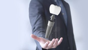 What Type of Dental Implant Will Suit You Best?