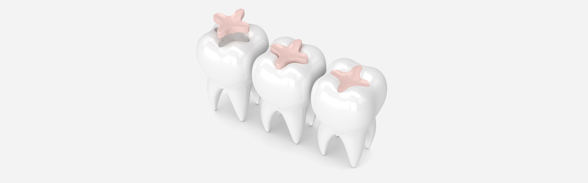 Can Dental Fillings Be Replaced? Signs It’s Time for a New One