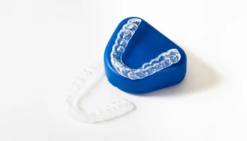 Invisalign Timeline Explained: How Long Does It Really Take to See Results?